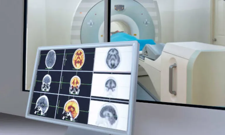 Thermal Control of MRI Systems