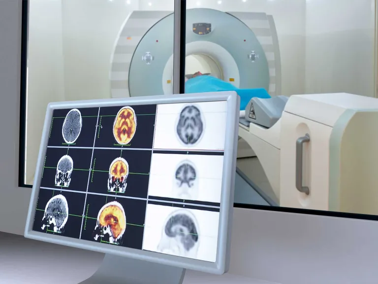 thermal-control-of-MRI-systems